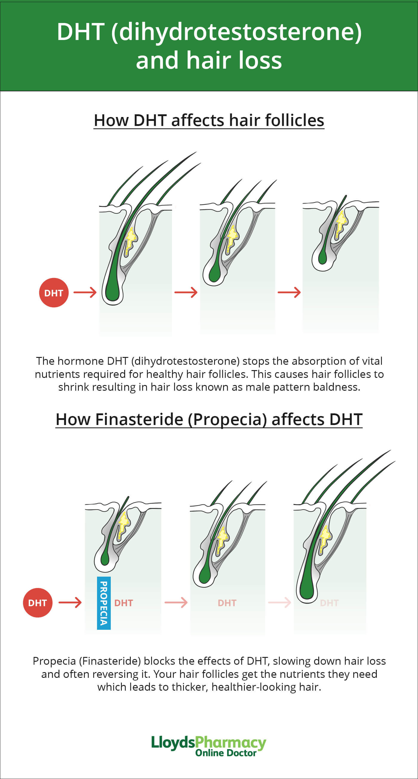 finasteride online