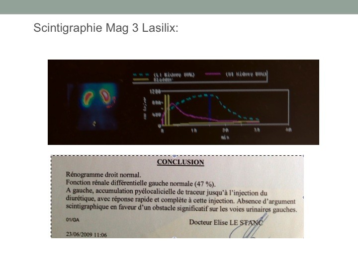 Lasilix France