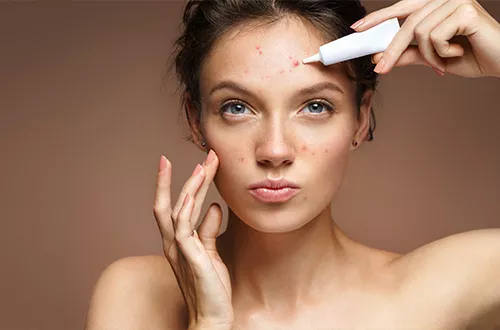 isotrétinoïne gel sans ordonnance