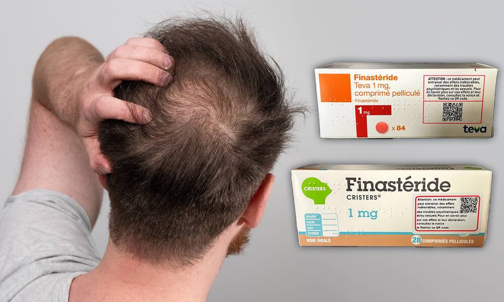 finastéride france acheter