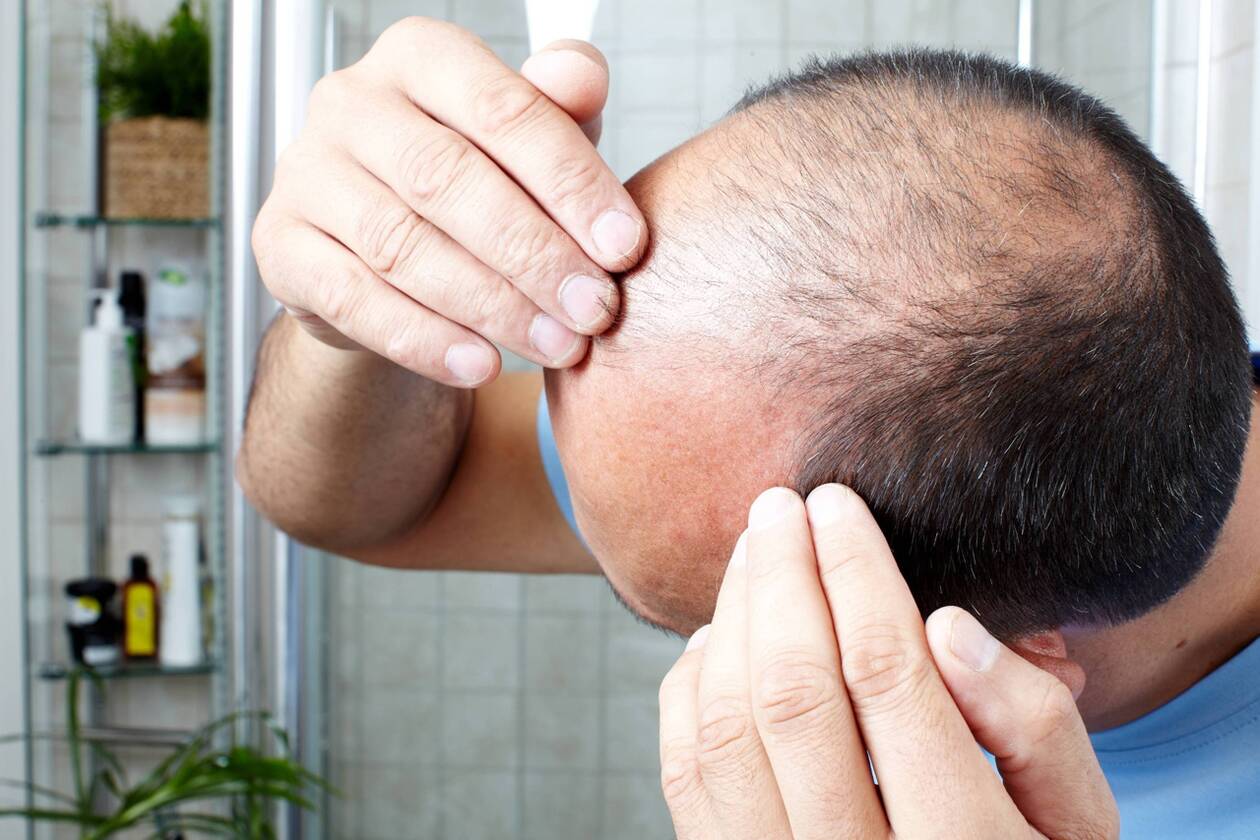 finasteride france acheter