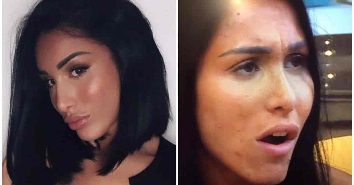 Roaccutane apres arret pilule