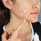 Isotretinoin france acheter