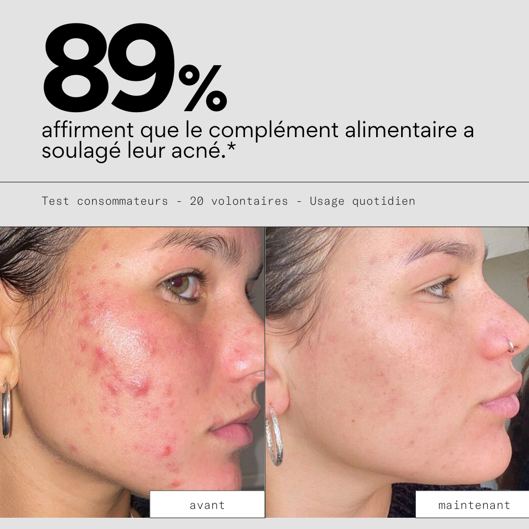 Roaccutane prix remboursement