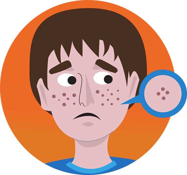 Roaccutane où acheter