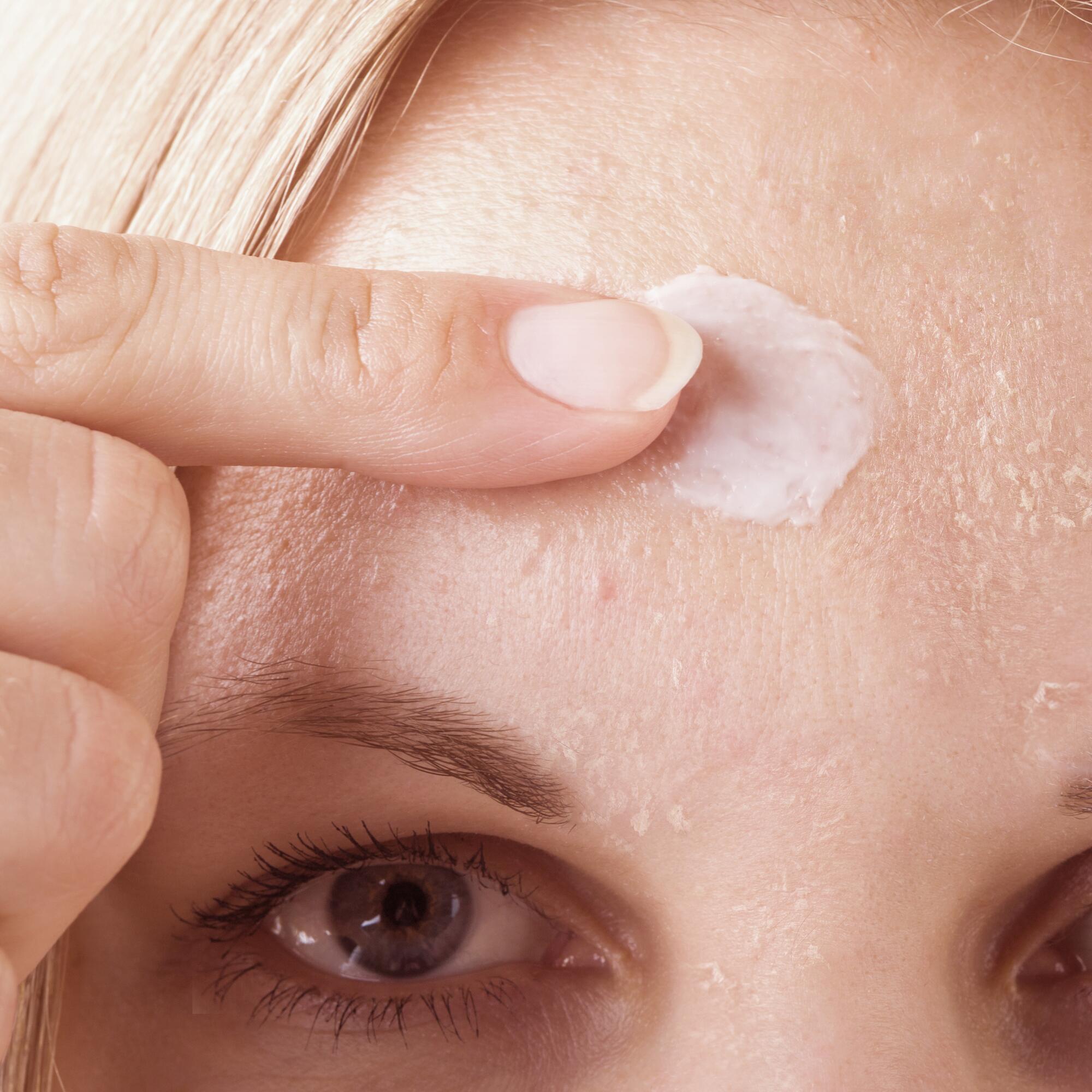 Isotretinoin en ligne
