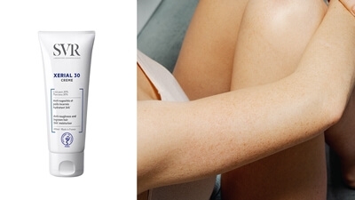 Ivermectine Creme Prix