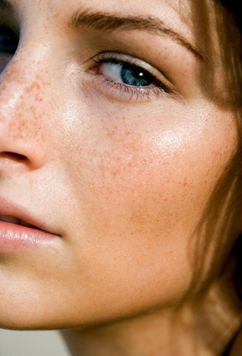 Comment Acheter Du Isotretinoin