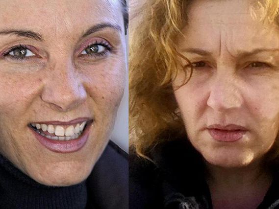 Coût Roaccutane