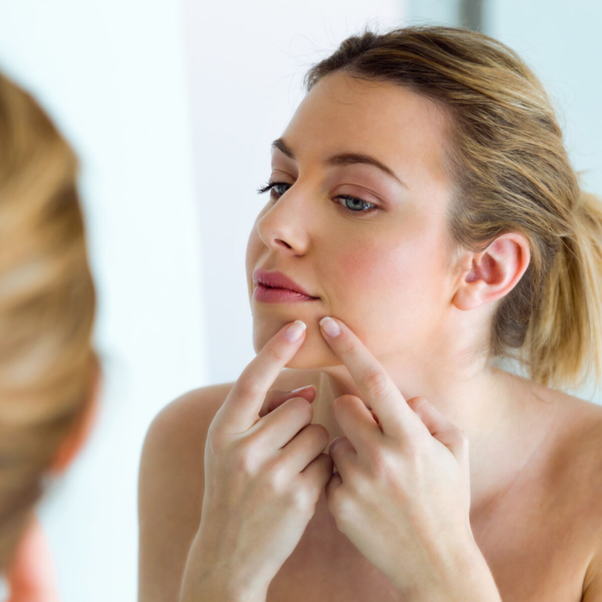 roaccutane france acheter