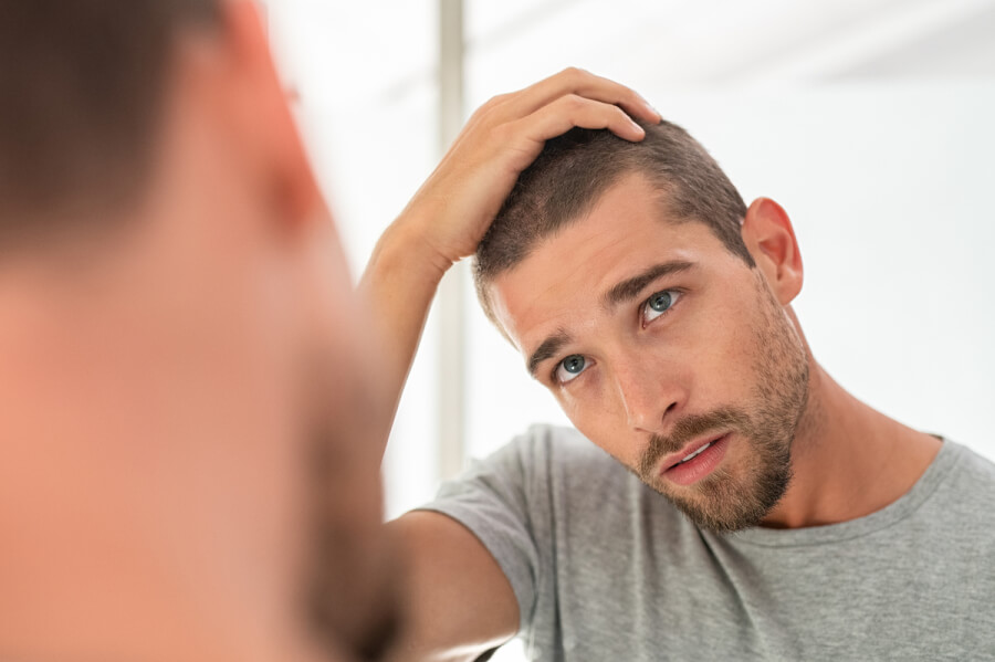Coût Finasteride
