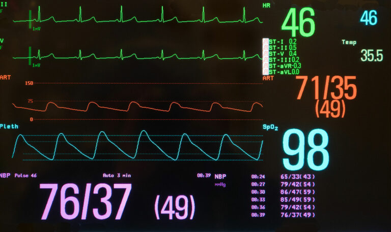 Propranolol Cap 80mg Er