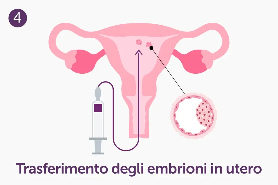 clomid online italia