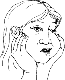 amoxicilline 500 mg pour les dents