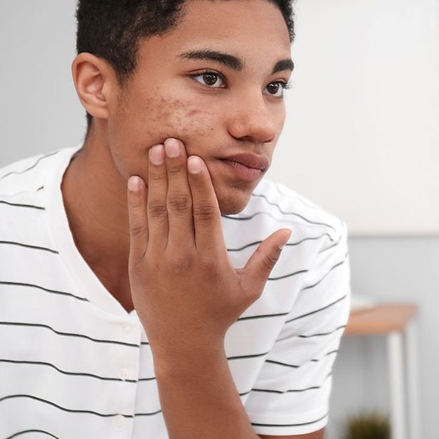Acheter Du Accutane En Ligne