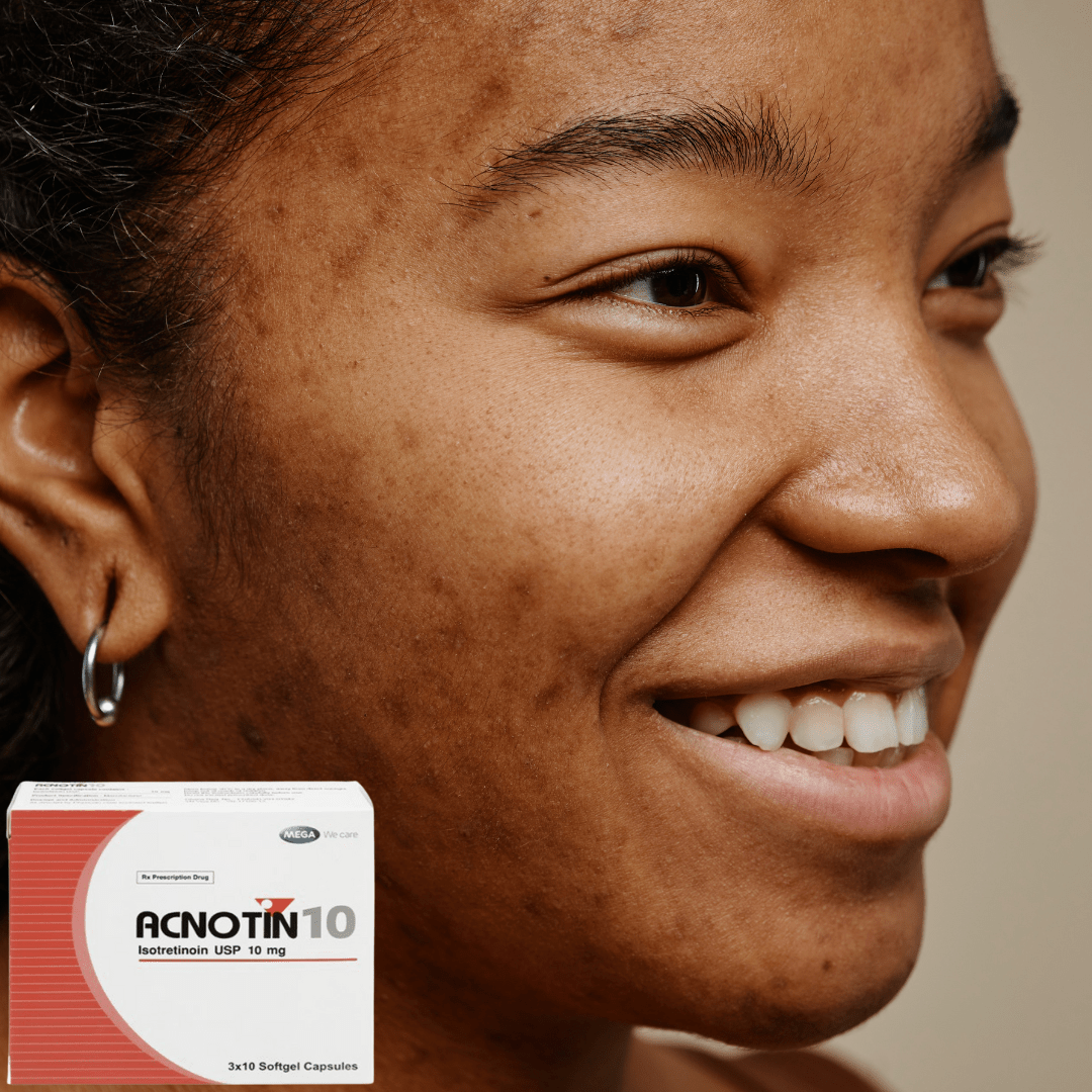 Accutane 10mg Online