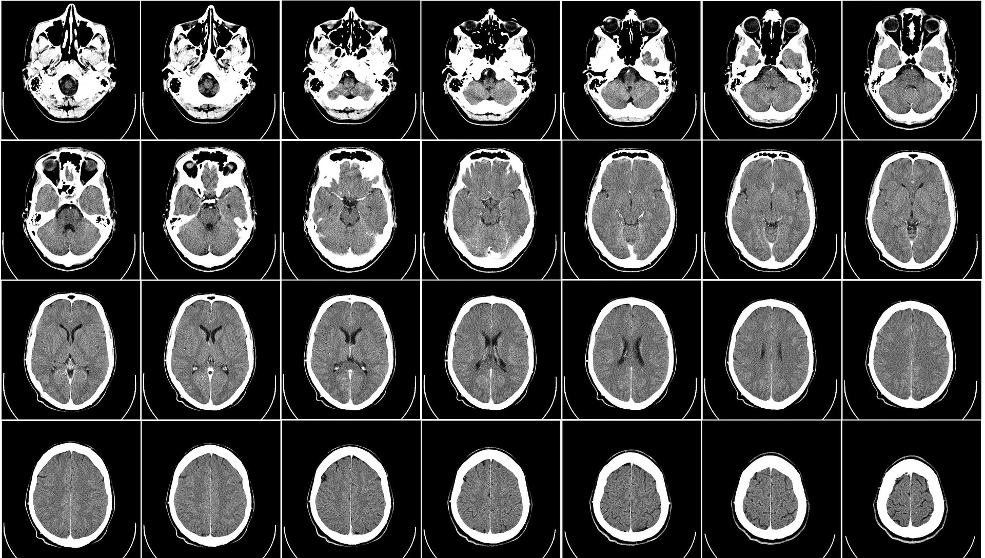 comment acheter du ativan