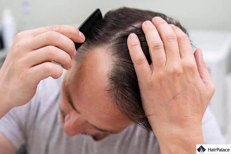 Comment Acheter Du Finasteride