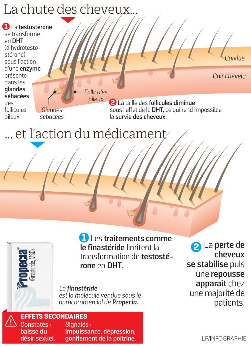 finasteride acheter