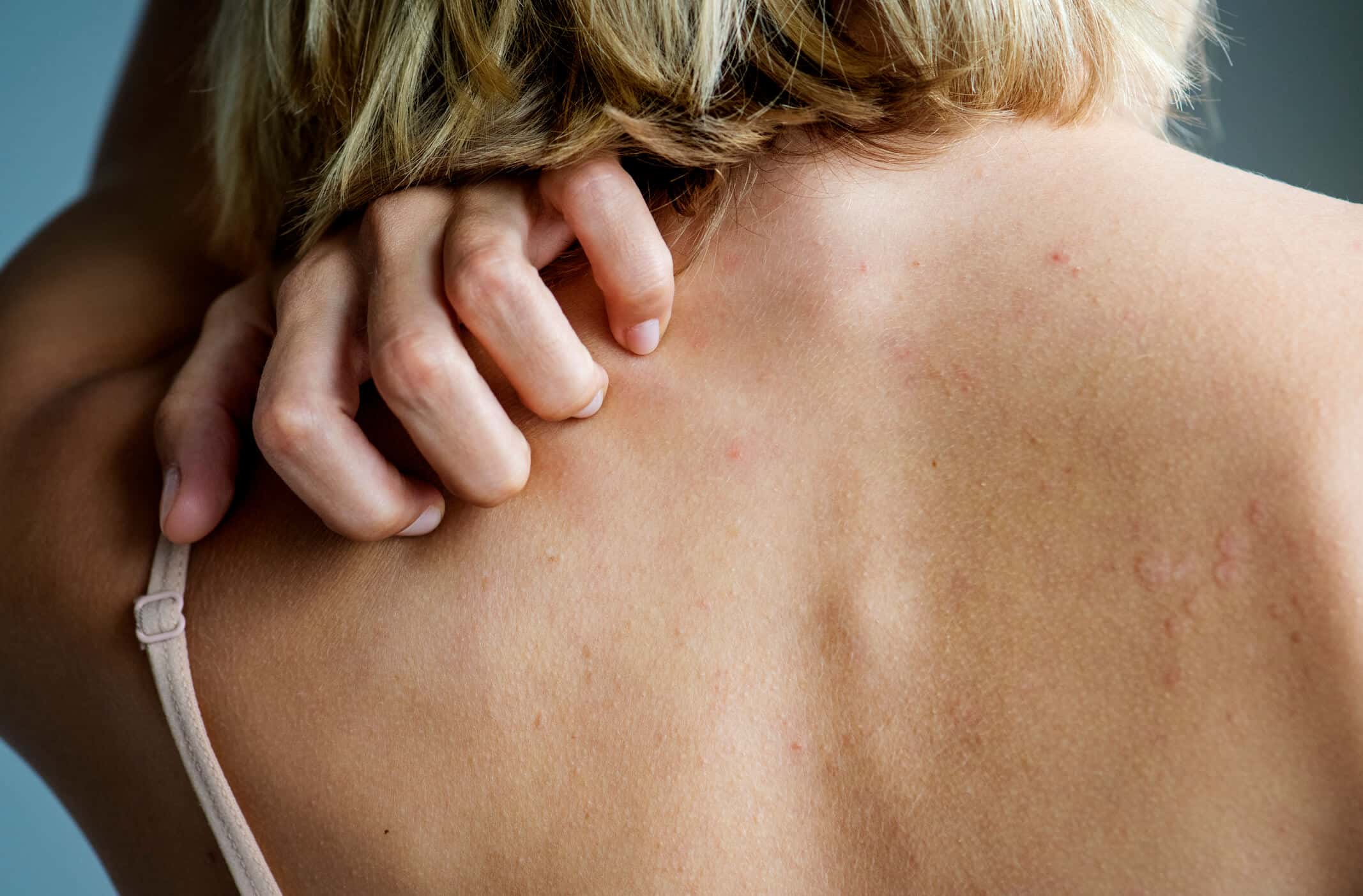 Stromectol Acheter Sans Ordonnance