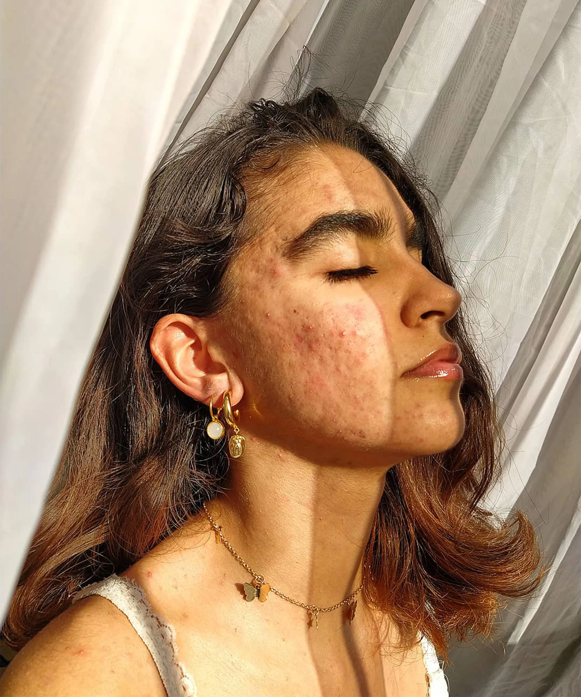 Commander roaccutane