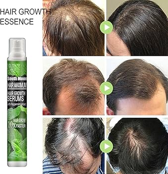 Finasteride Où Acheter