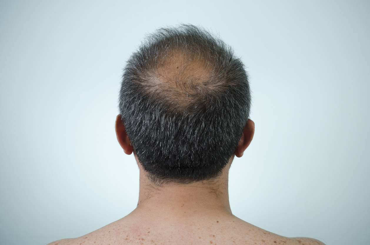 Finasteride Pilules