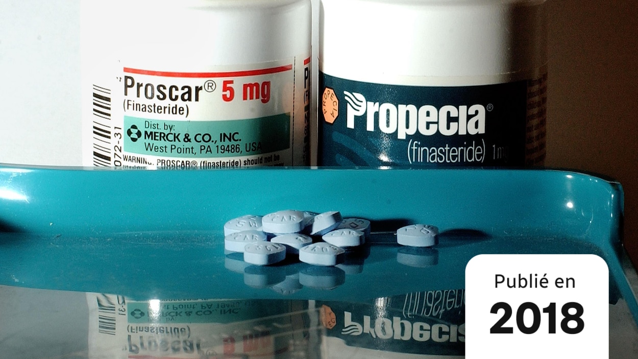 Finastéride 5 mg prix