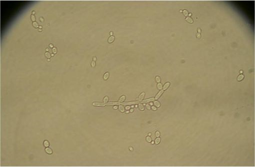 Fluconazole En Ligne