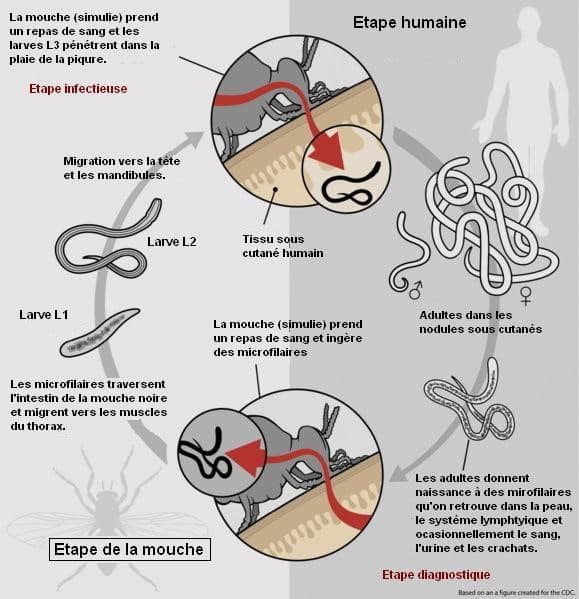Ivermectine où acheter