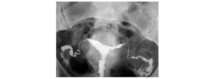 ordonnance en ligne clomid
