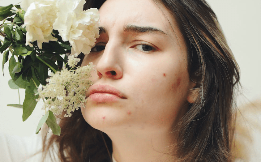 Pilule Contre Roaccutane