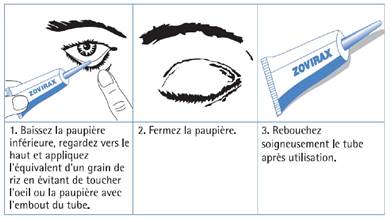 Prix Du Zovirax En Pharmacie