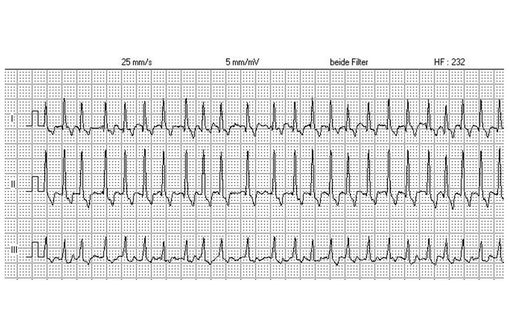 Propranolol 10 Mg 1mg