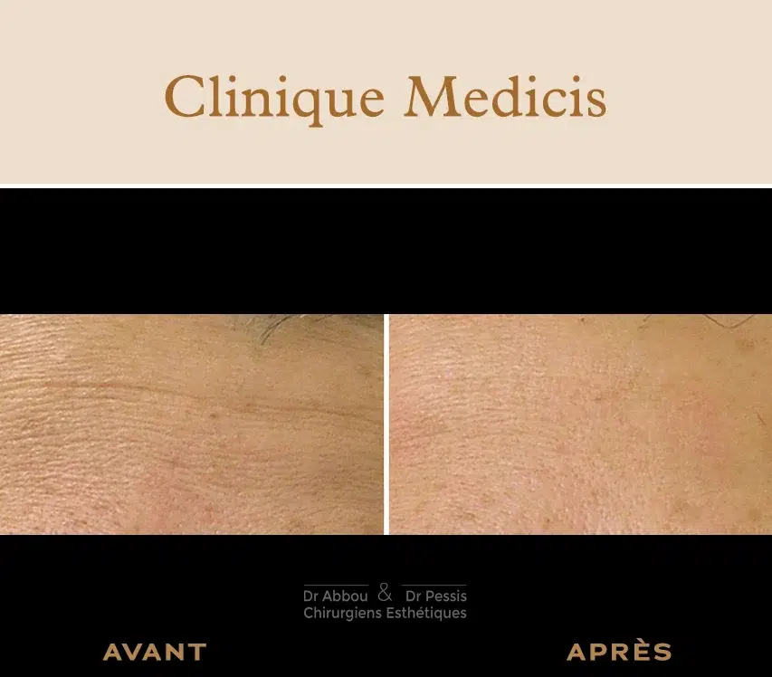 Roaccutane france prix