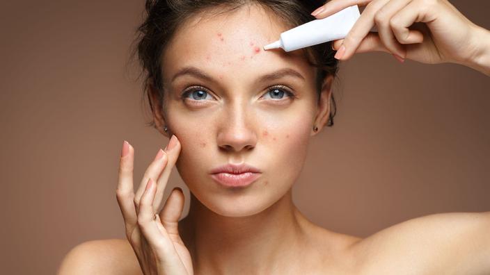 roaccutane quelle pilule