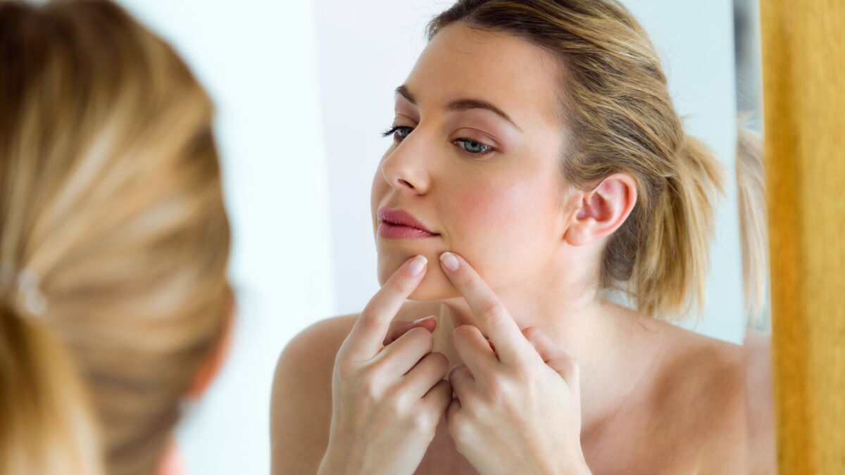 roaccutane sans pillule