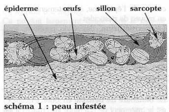 Stromectol Gale Prix